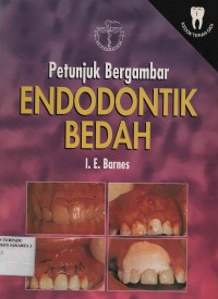 Petunjuk Bergambar Endodontik Bedah