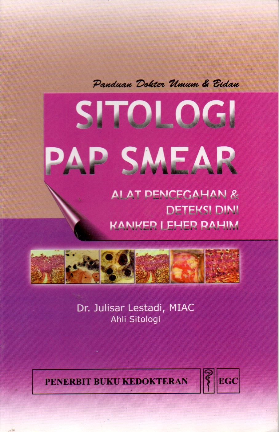 Sitologi PAP Smear : Alat pencegahan & deteksi dini kanker leher rahim
