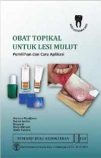 Obat Topikal Untuk Lesi Mulut : Pemilihan dan Cara Aplikasi