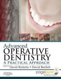 Advanced Operative Dentistry : A Practical Approach