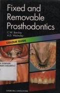 Fixed and Removable Prosthodontics