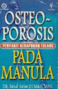 Osteoporosis Penyakit Kerapuhan Tulang Pada Manula