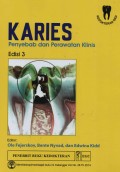 KARIES : Penyebab dan Perawatan Klinis (edisi 3)