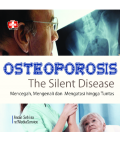 Osteoporosis The Silent Disease: Mencegah, Mengenali dan Mengatasi hingga Tuntas