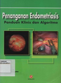 Penanganan Endometriosis Panduan Klinis dan Algoritme