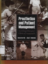 Prosthetics and Patient Management - A Comprehensive Clinical Approach