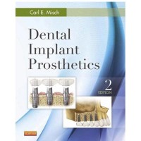 Dental Implant Prosthetics edition 2