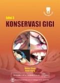 Konservasi Gigi