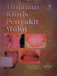 Tinjauan Klinis Penyakit Mulut