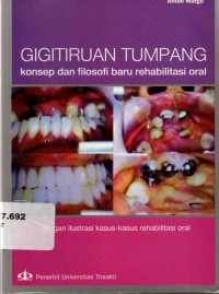 Gigitiruan Tumpang: Konsep dan Filosofi Baru Rehabilitasi Oral