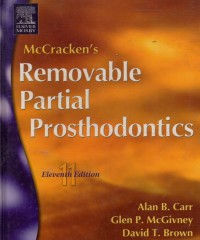 McCracken's Removable Partial Prosthodontics edition 11