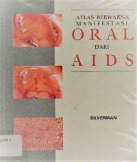 Atlas Berwarna Manifestasi Oral dari Aids