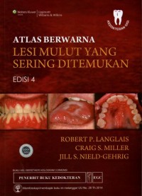 Atlas Berwarna Lesi Mulut Yang Sering Ditemukan Edisi 4