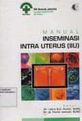 Manual Inseminasi Intra Uterus (IIU)