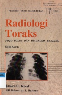 Radiologi Toraks : foto polos dan diagnosis banding