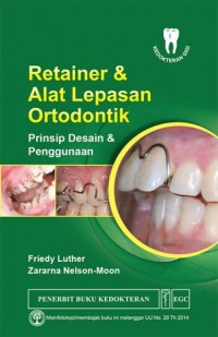 Retainer & Alat Lepasan Prinsip Desain & Penggunaan