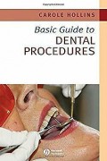 Dental Procedures : Basic Guide to