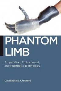 Phantom Limb : Amputation, Embodiment, and Prosthetic Technology